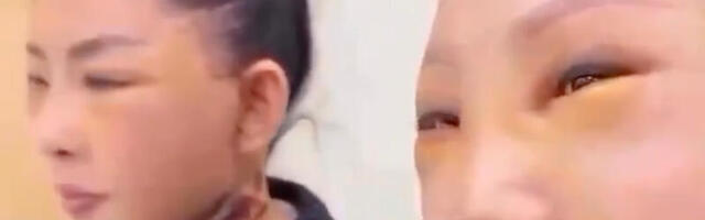 VIDEO: Hiinas on hakatud vanematele naistele siirdama tüdrukute nägusid