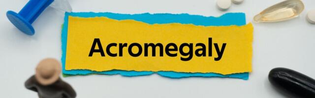 Akromegaaliat põhjustab healoomuline kasvaja ajus