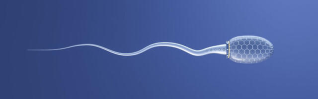 Spermadoonori šokeeriv juhtum