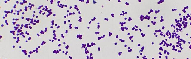 2019. aastal olid teiseks surmapõhjuseks bakterite põhjustatud infektsioonid