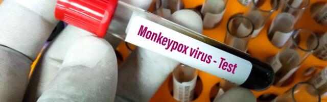 30-s riigis, kus viirus ei ole endeemiline, on leitud üle 780 ahvirõugete juhu