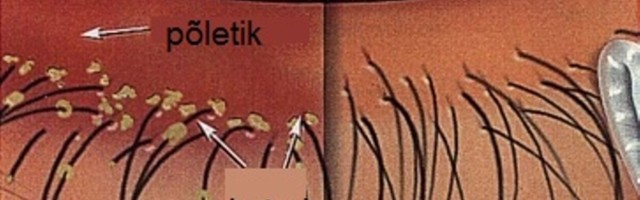 Lipiidide gradient, mis hoiab silmad niisked