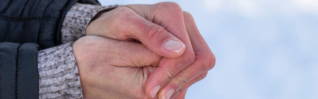 Kas sul on kuiv või ülikuiv nahk? Spetsialist selgitab, kuidas vahet teha