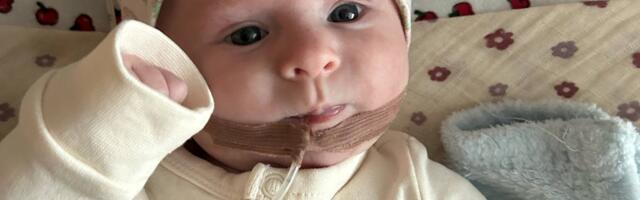 Pisitüdrukut ootab Helsingis keeruline operatsioon: palun aita emal olla sel raskel ajal oma pisitütre kõrval!