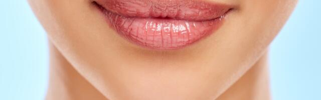 Povećajte volumen usana prirodnim putem