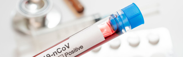 Koroonaviirus Eestis, 22. september: ööpäevaga lisandus 36 positiivset testi