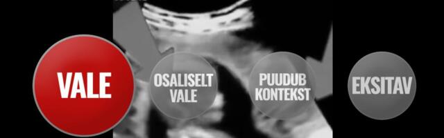 FAKTIKONTROLL | Populaarne video ei näita aborti, vaid lõiku propagandafilmist