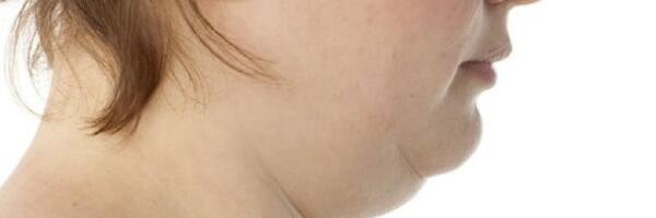 Vabane topeltlõuast igaveseks selle lihtsa trikiga