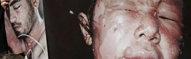 Millist kahju keemiarelvad tekitavad?