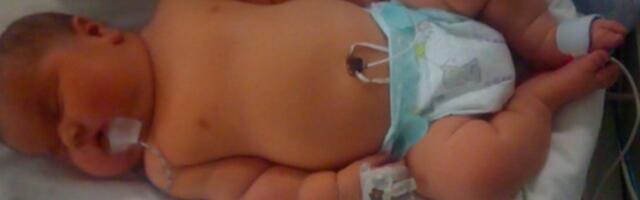 Ühendkuningriigis sündis ebatavaliselt suur beebi