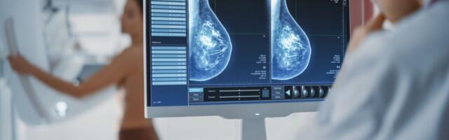 TAI: 2020. aastal diagnoositi Eestis 8225 vähi esmasjuhtu