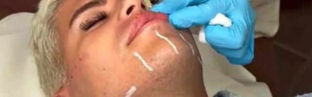 Nakon što je viđen u klubu prerušen u ženu, Uroš Stanić je uradio ova tri estetska zahvata: Usne, jagodice, botoks...