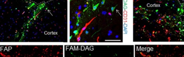 Tartu teadlane avastas uue viisi ajuhaiguste raviks