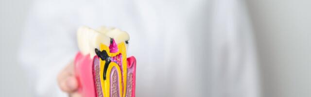 KURIOOSUM: pool aastat poja hambaid mitte pesnud Rootsi ema sai kopsaka trahvi