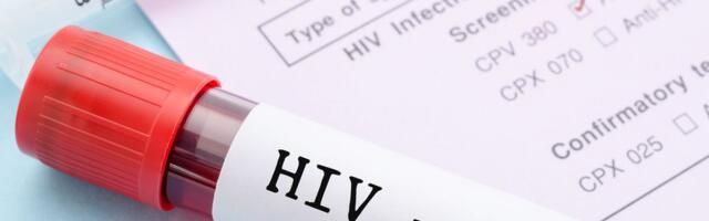 Teismeline tüdruk võttis kohutava terviseriski, et poisile oma pühendumust tõestada