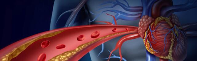 Kolesterool – hea või halb