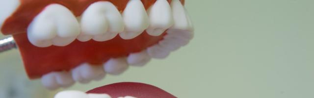 Korralik teenistus: ortodontide palgatase ulatub 9000 euro kanti
