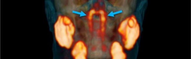 Polnudki kõik teada: inimkehast leiti uus elund!