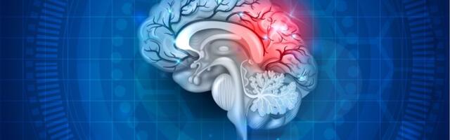 Intravenoosne trombolüüs ajuinfarkti ravina vähendab tulevikus dementsuse riski