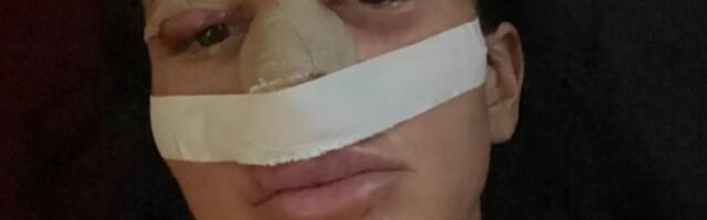 RIJALITI UČESNICA POSLE NIZA OPERACIJA U LOŠEM STANJU: "Ne mogu da govorim, cela sam otečena"