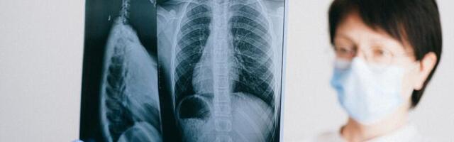 Kliinikumis viidi läbi innovaatiline virtuaalnavigatsiooni bronhoskoopia