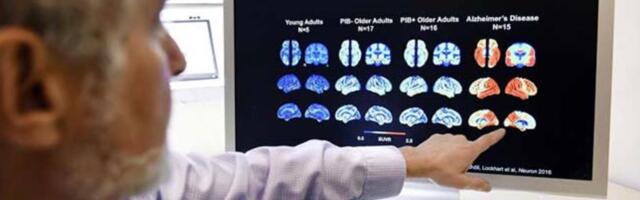 Diabeedi ja Alzheimeri tagasipööramine: teaduslik vaade võimalustele