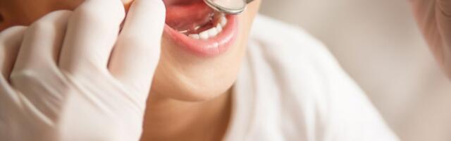 Haigekassa: lastele on hambaravi rahastus jätkuvalt tagatud