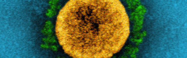 Lihtsalt ja lühidalt: mis on Eestit ohustav koroonaviiruse Briti tüvi?