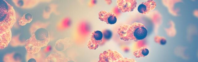 Riigikontroll: vähiravi algust tuleb kiirendada ja sõeluuringuist osavõttu suurendada