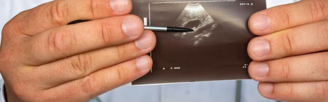 Millist kahju teevad meile salakavalad sapikivid?