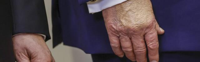 Trump ütles, et võtab vere vedeldamiseks rohkem aspiriini, kui arstid soovitavad