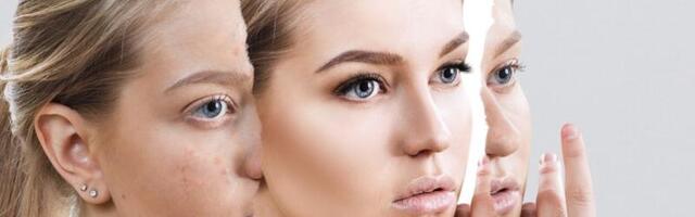 NAHAARST BRET KALDVEE: kui üle 25 aastaselt vistrikud endiselt kimbutavad, siis … .