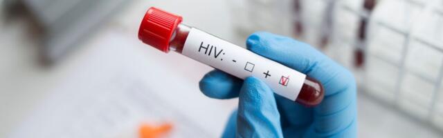 Uus HIVi variant viib kiiremini AIDSi tekkeni