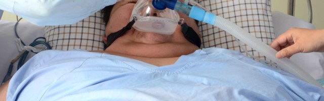 Uuring: ülekaaluliste kodanikega riikides on koroonasuremus kordi suurem