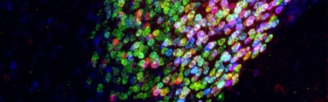 OLULINE AVASTUS | Teadlased leidsid ajus koha, mis kaotab igasuguse valu