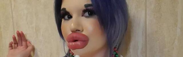 Põhjus, miks maailma suurimate huultega naine 27. korda täitesüstimisele läheb