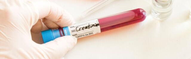 Kõrge kreatiniini tase võib viidata mitmele haigusseisundile