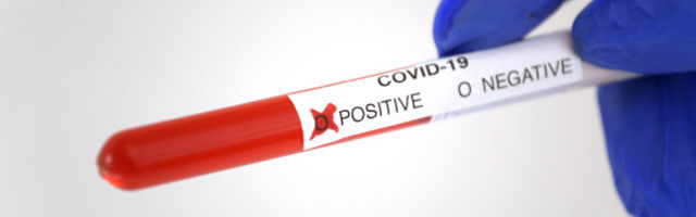 GRAAFIK | Terviseamet: ööpäevaga lisandus kaks positiivset koroonatesti