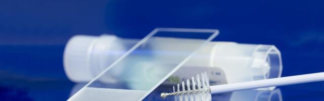 Kodused HPV-testid osutusid populaarseiks