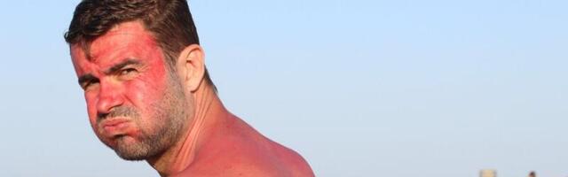 Lätis kutsub arstide ühing üles vältima UV-kiirgust