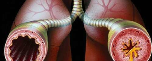 Hingamistehnika sõltub inhalaatori tüübist