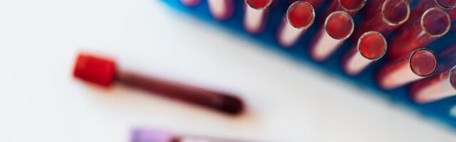 TAI kutsub kõiki kontrollima end HIV ja teiste seksuaalsel teel levivate infektsioonide suhtes