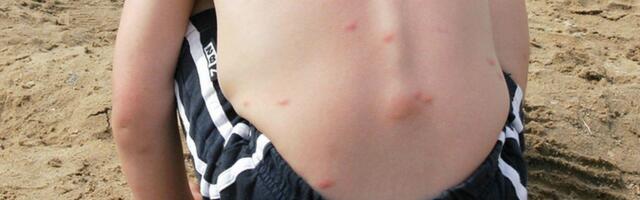 Vihatud tserkaarid on kohal. Viljandi järve vesi tekitab ujujatel taas löövet