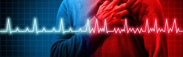 Uuring: Naharavim võib aidata ravida südame arütmiat