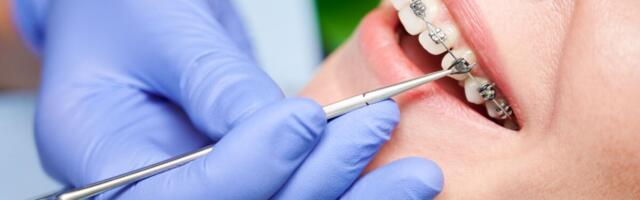 Ortodontide keskmine kuupalk ületab 11 000 eurot