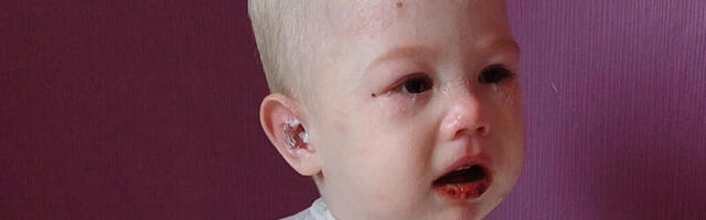 AITA SOETADA RAVIGEEL, MIS PARANDAB HAAVU JA LEEVENDAB VALU