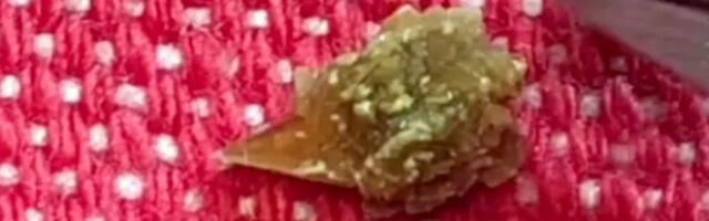 Britt näitab, milline neerukivi temast "loomulikul" teel väljus