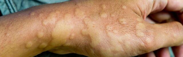 Uus teadusuuring: DNA saastumine Comirnaty´sega, kus on 500-kordne saasteainete hulk lubatud tasemest