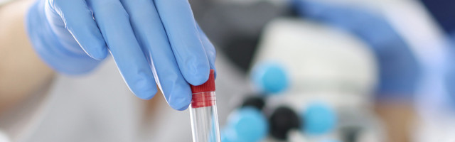 Koroonaviirus Eestis, 15. detsember: ööpäevaga lisandus 301 positiivset, suri kolm