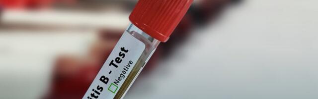 USA muutis järsult kurssi vastsündinute B-hepatiidi vaktsiini osas